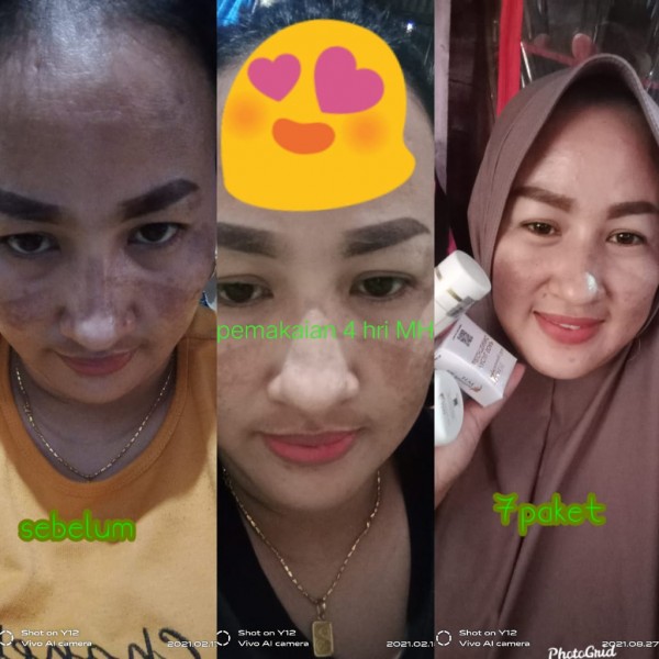 MH whitening skin Maulagi