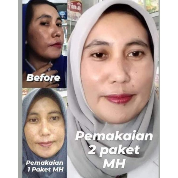 MH whitening skin Maulagi